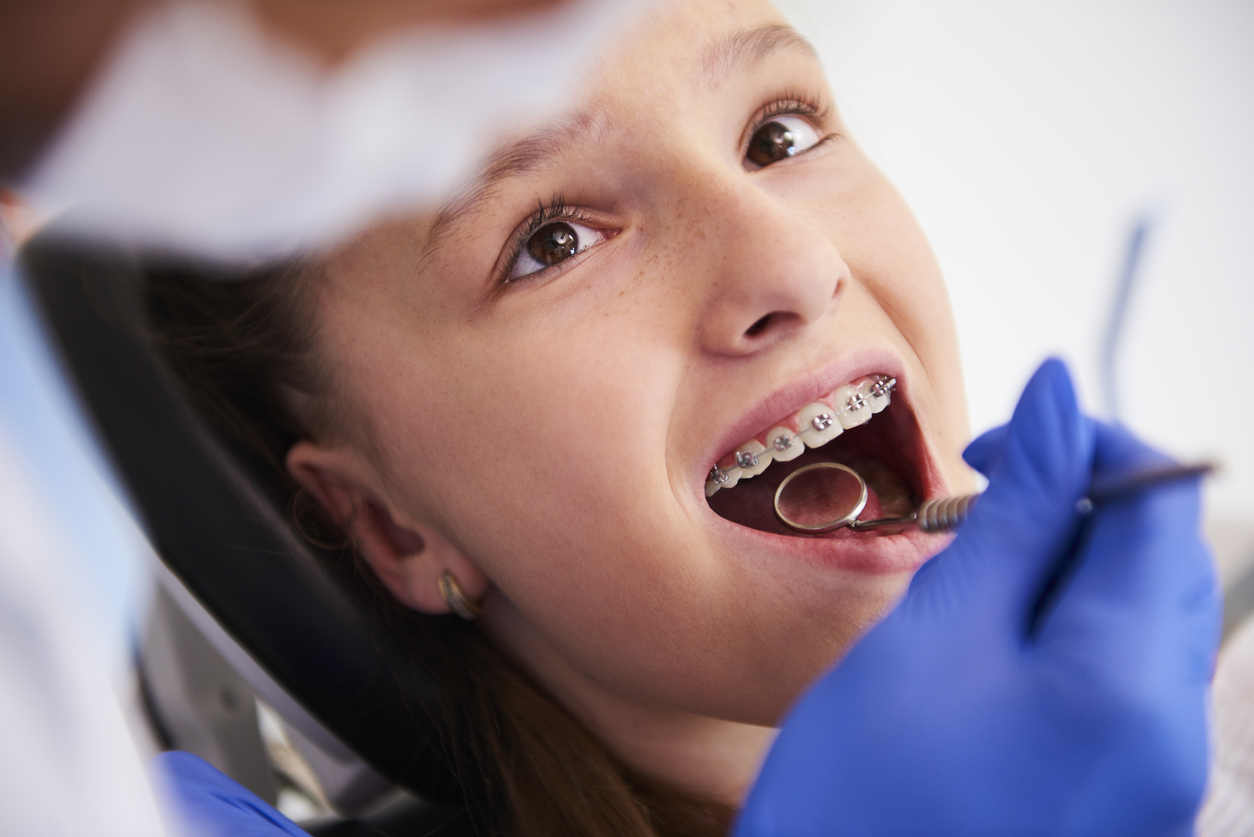 Claves para descubrir si tus hijos necesitan un tratamiento de Ortodoncia